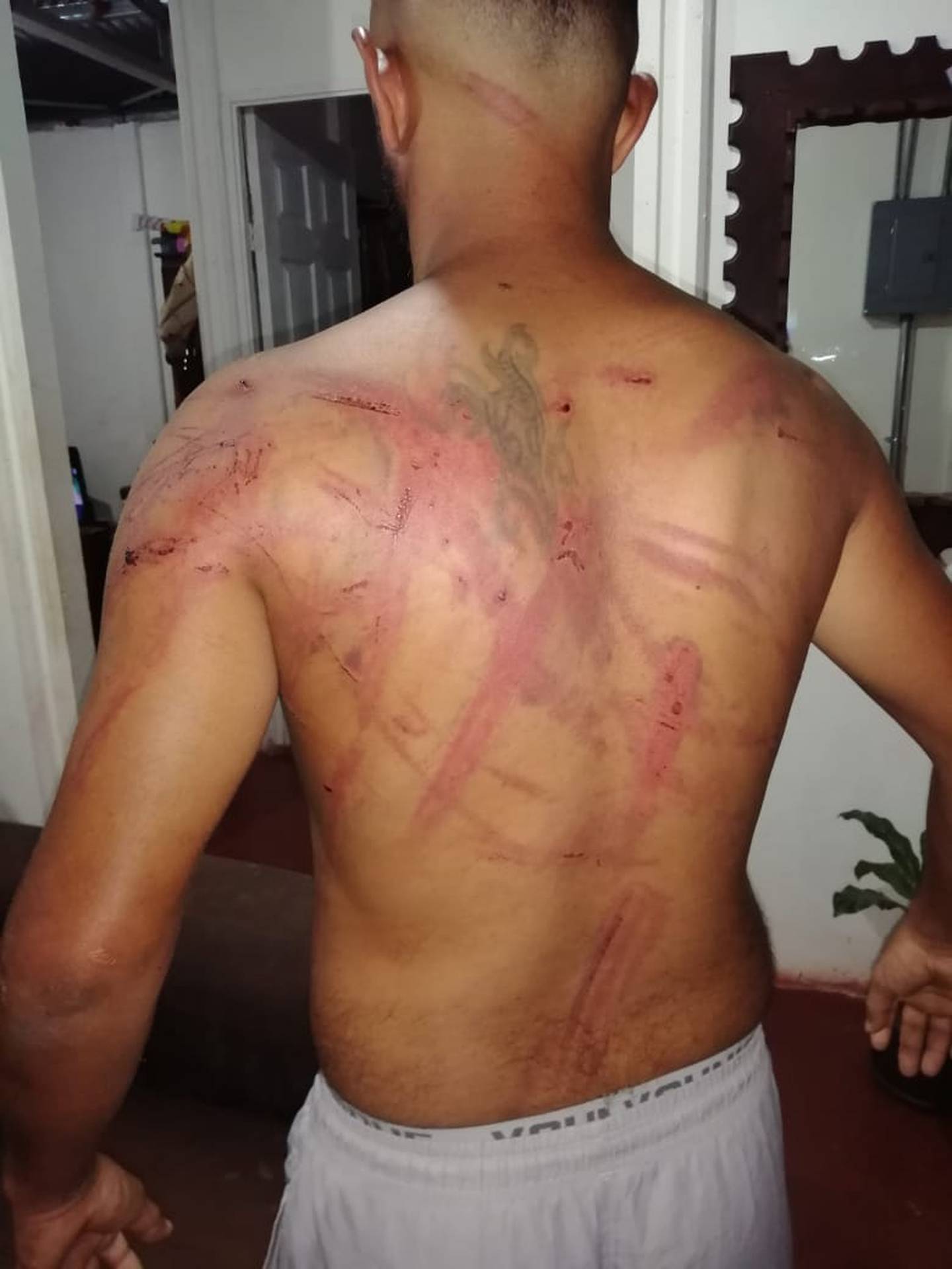 Joven denuncia que atacado por grupo de "garroteros" por delito que no cometió. Foto suministrada por Edgar Chinchilla.