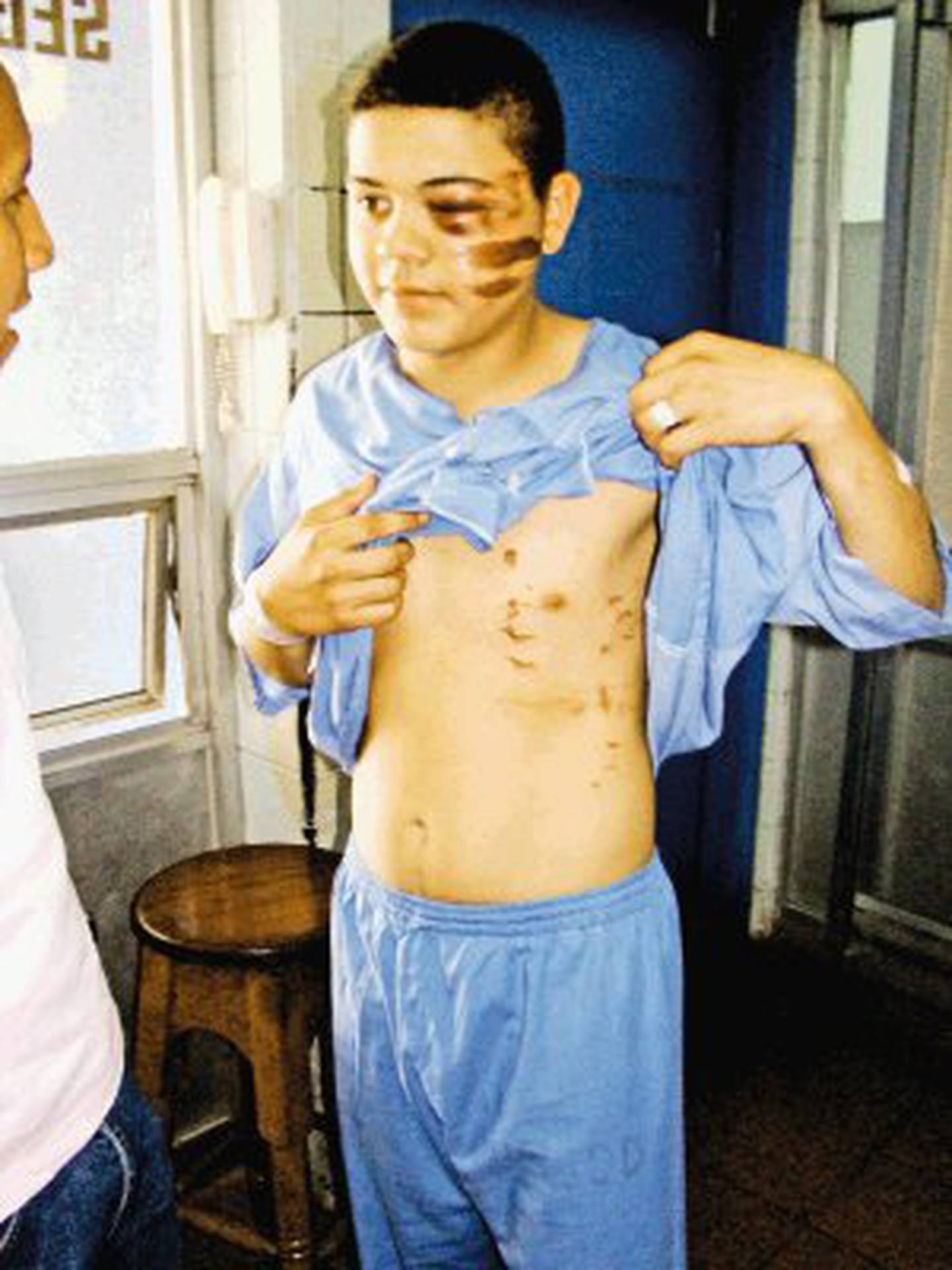 Deiner Durán Fonseca, único sobreviviente de un accidente ocurrido en el 2008 en el que fallecieron tres de sus amigos. Foto Archivo.