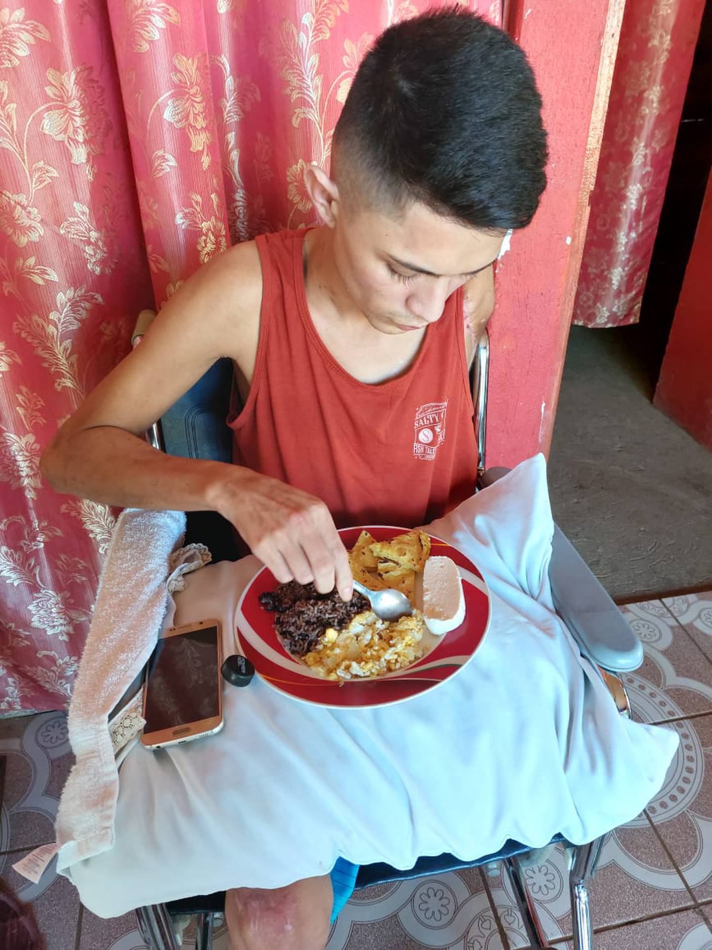José Enrique Varela, joven que perdió su brazo izquierdo y pierna izquierda en accidente de tránsito. Foto cortesía José Enrique Varela.