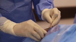 Medicina legal vuelve a extraer córneas en fallecidos para trasplantes 