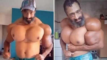 Murió el Hulk, brasileño que se inyectaba aceite en los músculos