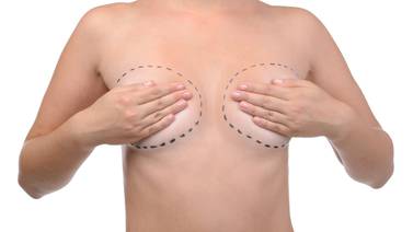 Salud advierte que implantes de mama pueden dar cáncer  