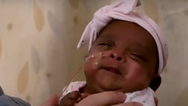 Bebé más pequeña del mundo: pesó al nacer lo mismo que una manzana