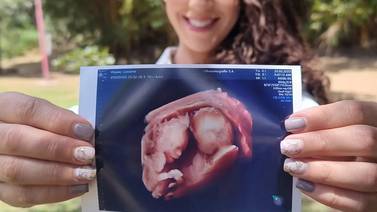 ¡Pobrecita! Lussania Víquez mostró la parte de su cuerpo que más está sufriendo por el embarazo