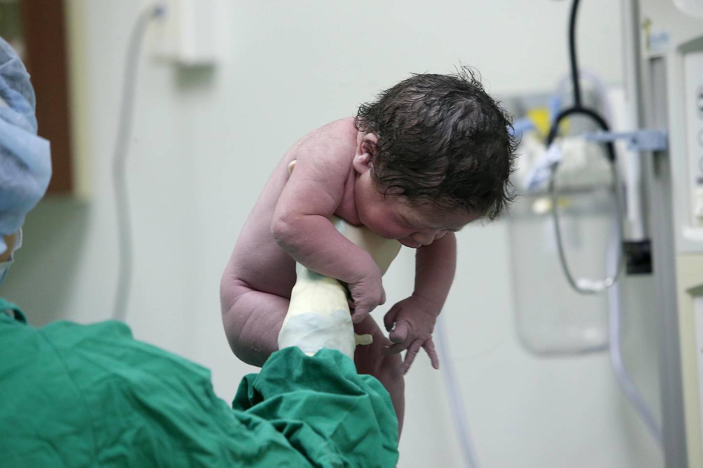 Eithan Jesús Brenes Alvarado durante el proceso de revisión después de haber nacido. Pesó 3.790 gramos y midió 53 centímetros.