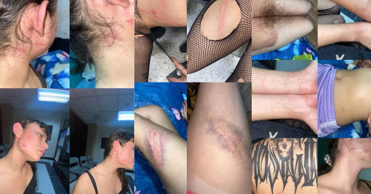 Estas fueron las fotografías que adjuntó la afectada en su denuncia pública en Instagram. Fotos: Reproducción