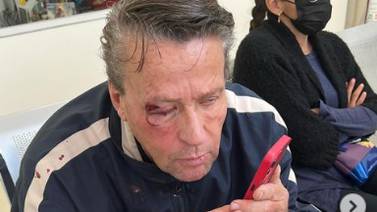 Alfredo Adame tiene 3 fracturas de cráneo producto de la golpiza que recibió