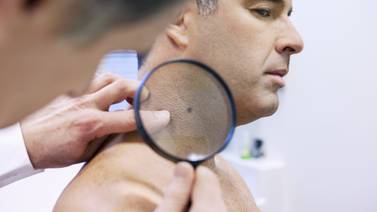 Cáncer de piel: Aprueban dispositivo portátil que ayuda a detectar tumores de forma inmediata
