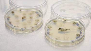 Ameba come cerebros vive en termales de Bagaces