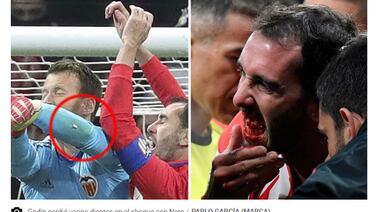 Portero del Valencia le apea varios dientes al jugador Diego Godín