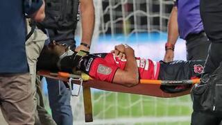  Celso Borges se recupera luego del golpazo que recibió en el juego ante Sporting