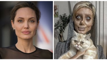 Joven se sometió a 50 cirugías para lucir como Angelina Jolie