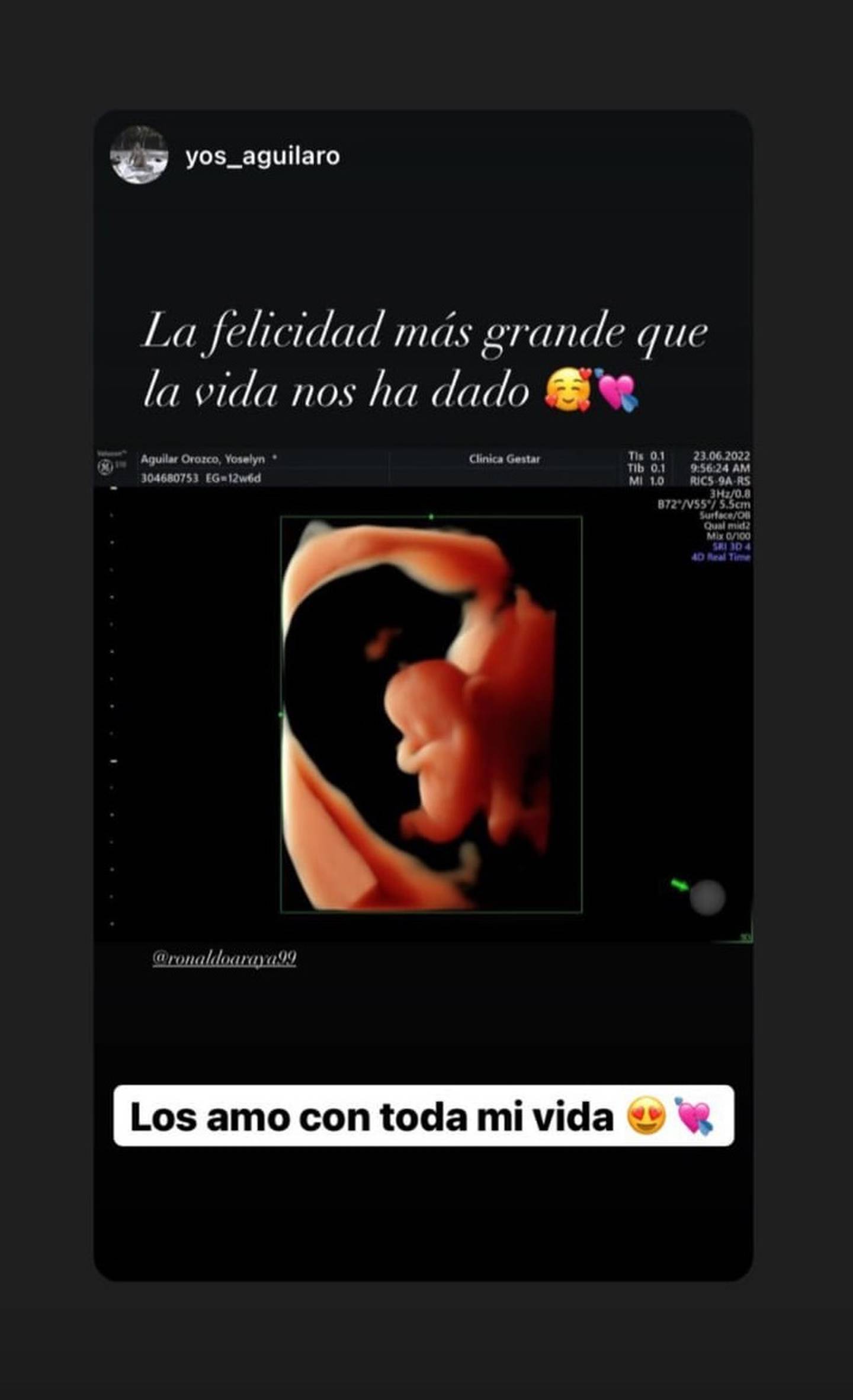 Luis Ronaldo Araya anunció que se convertirá en papá. Instagram.
