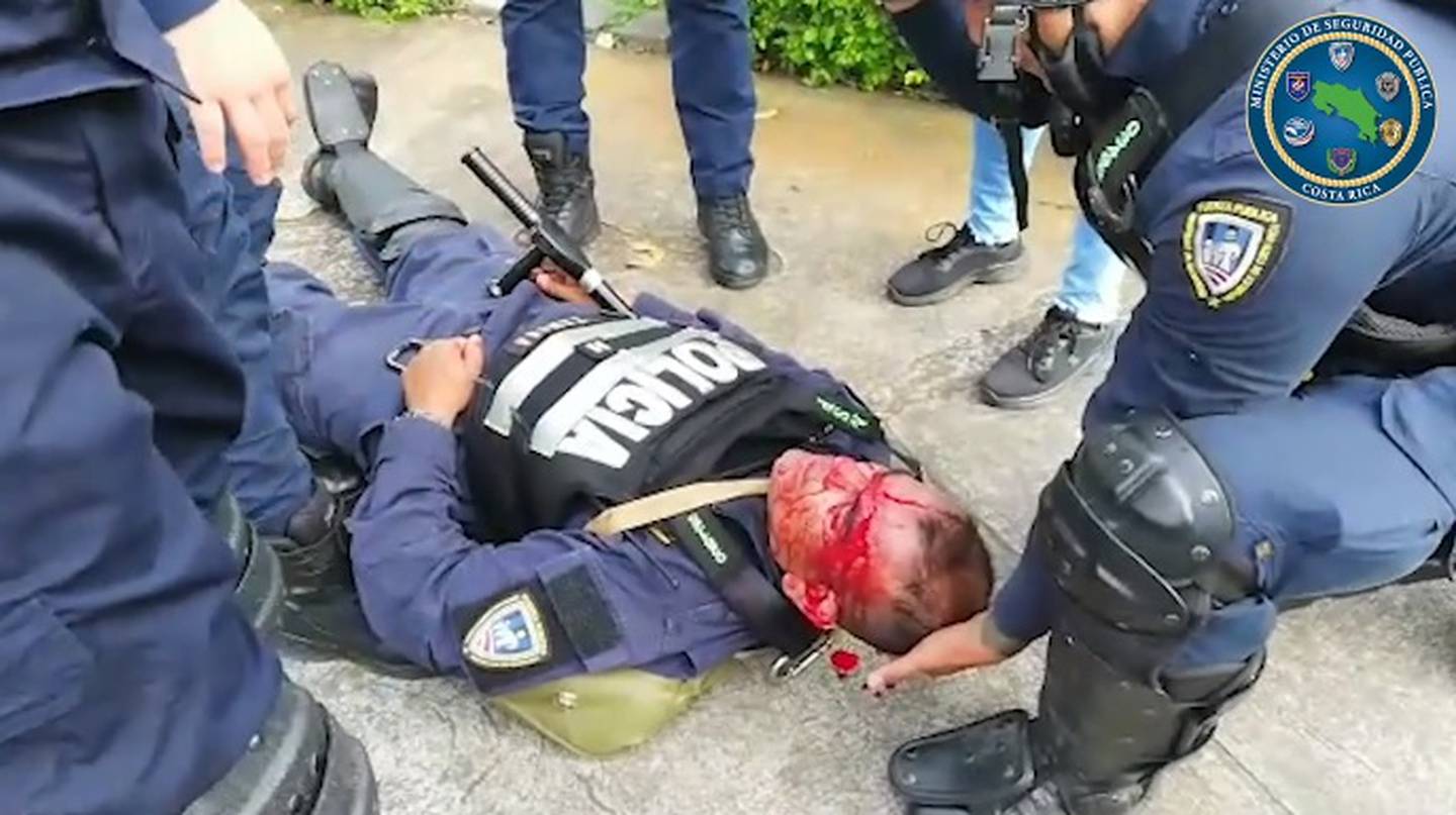 Oficiales de la Fuerza Pública heridos en la batalla campal contra manifestantes frente a Casa Presidencial el 12 de octubre del 2020