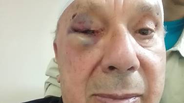 Exgerente del Banco Nacional es atacado a golpes y amordazado por asaltante dentro de su propia casa 