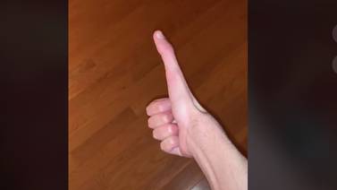 Lo comparan con ET por el tamaño tan exagerado de su dedo (video)
