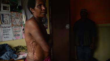 Papúa, el país donde la cacería de ‘brujas’ aterroriza a las mujeres