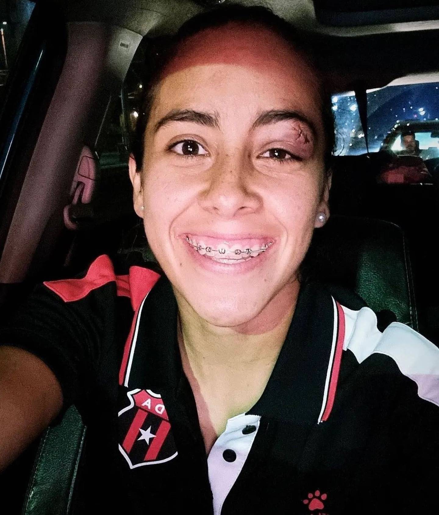 Viviana Chinchilla, jugadora de Alajuelense. Instagram.