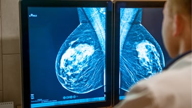 ¡Increíble! Entrega de resultados de mamografías tarda hasta un año