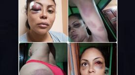 Wendy Myrie le ruega a Fiscalía de Limón pasar su caso de violencia doméstica a San José 