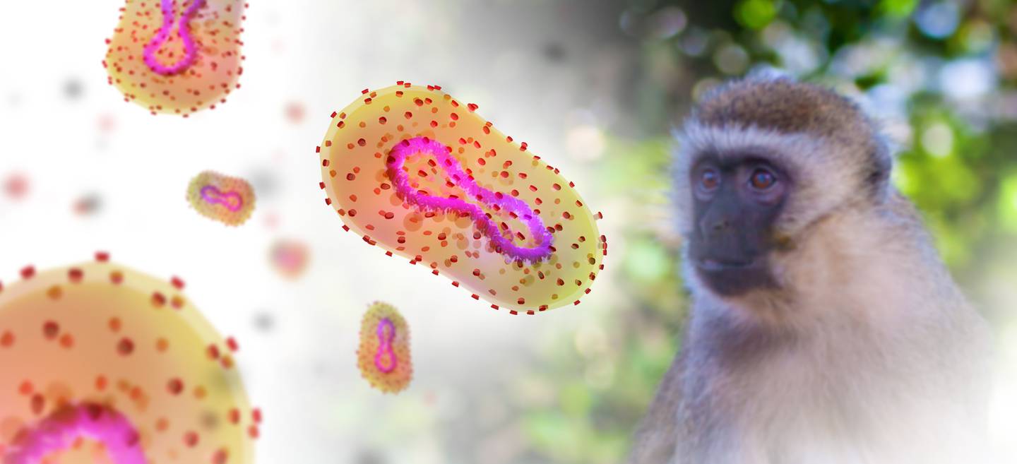 Monkeypox ,Outbreak,Concept., Monkeypox,Is,A,Viral,Zoonotic,Disease.,Monkeypox