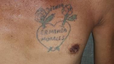 OIJ espera que tatuaje ayude a identificar a hombre que murió atropellado hace tres meses