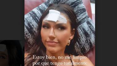 Miss Costa Rica Valeria Rees se rompió la frente al pegar contra el lavamanos