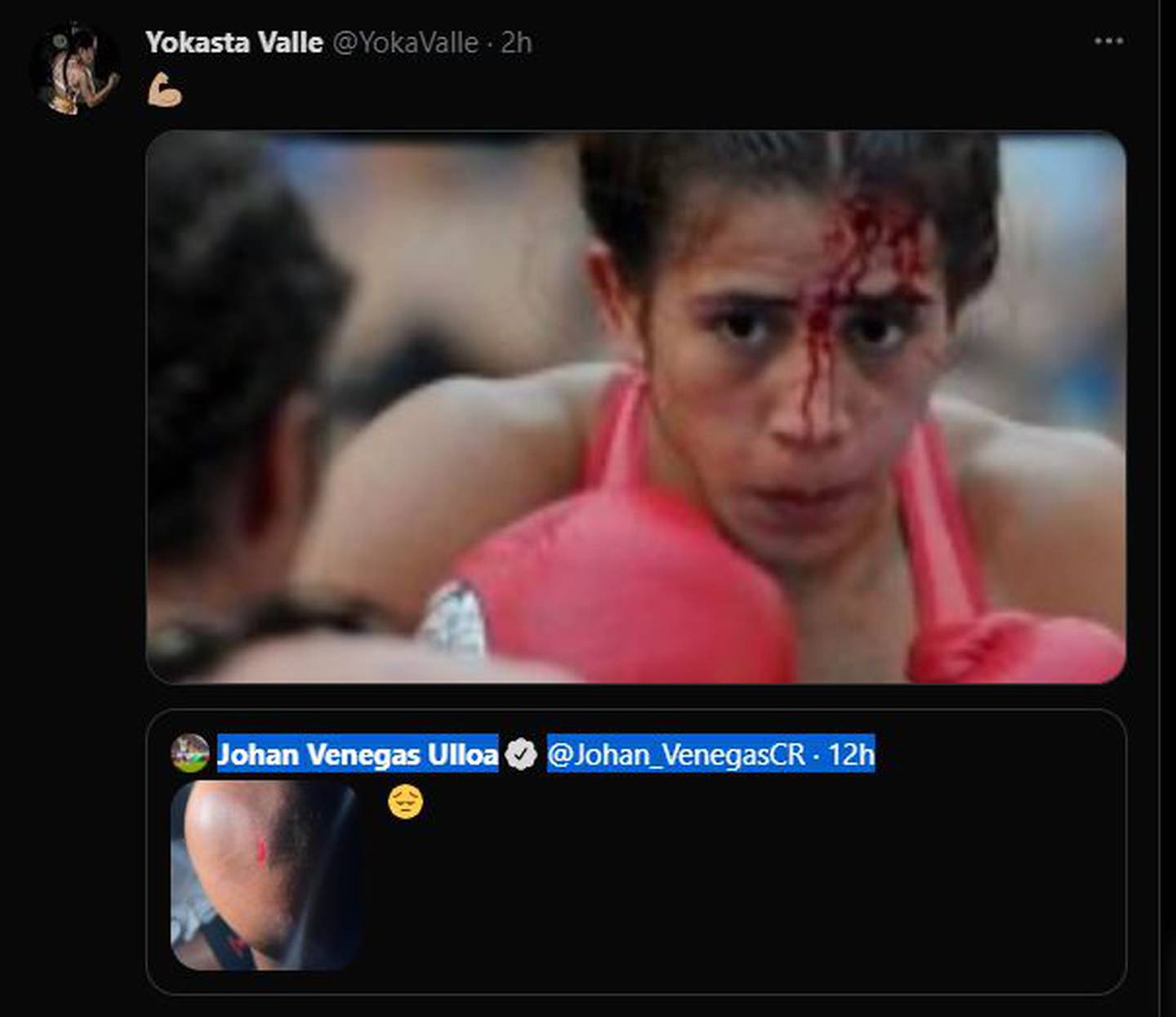 Yokasta se puso los guantes y le mandó un jab a Venegas. Twitter.