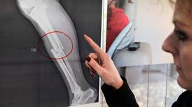 (Fotos) Exponen fracturas y hasta una puñalada para denunciar violencia contra la mujer