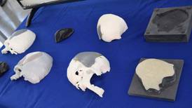 Se harán prótesis craneales con impresora 3D  en Costa Rica 