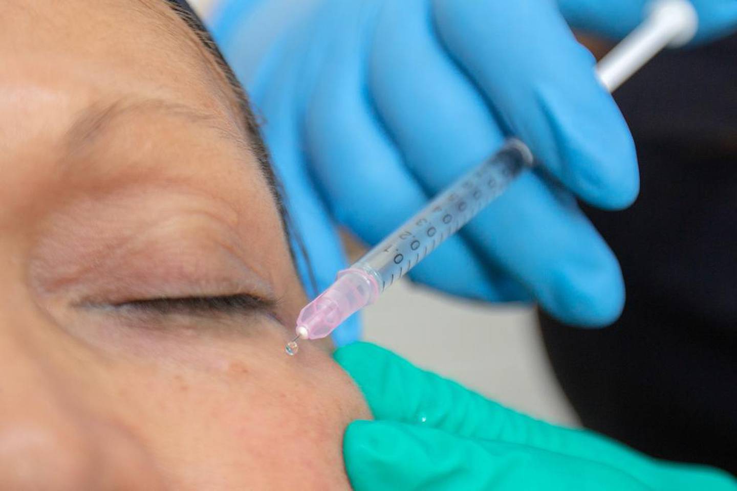 La doctora Karla Aguilar Moya, presidenta de la Asociación Científica Costarricense de Longevidad y Medicina Estética (ACCOLME), denuncia que hay epidemia de odontólogos poniendo Botox.