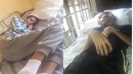 Familia lleva 122 días de angustia por atropello que dejó a joven en cama