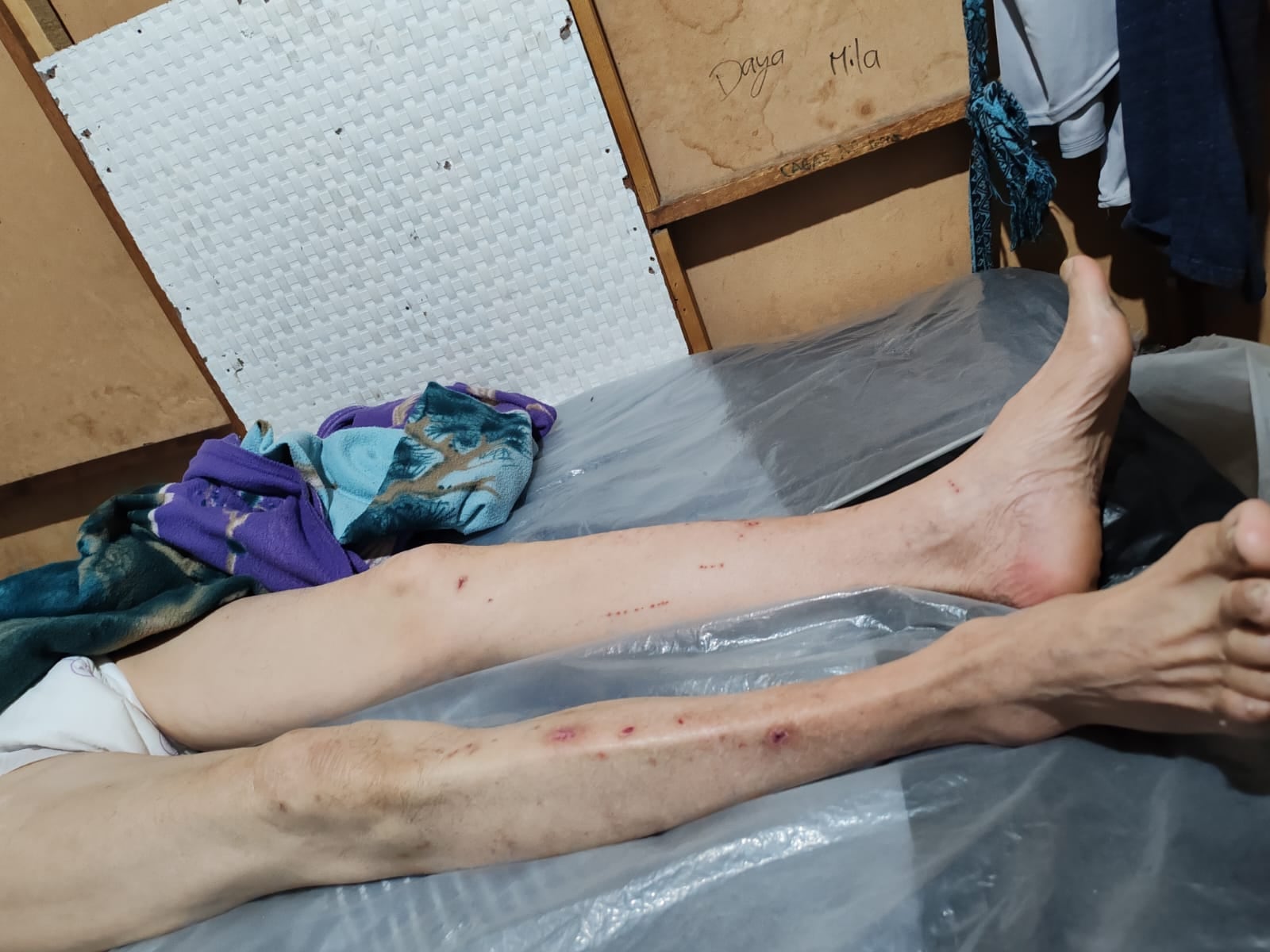 Cristian Varela contó que cada día ve el deterioro de la salud de su papá, Guillermo Varela Sancho, quien tiene cáncer de próstata y esquizofrenia.