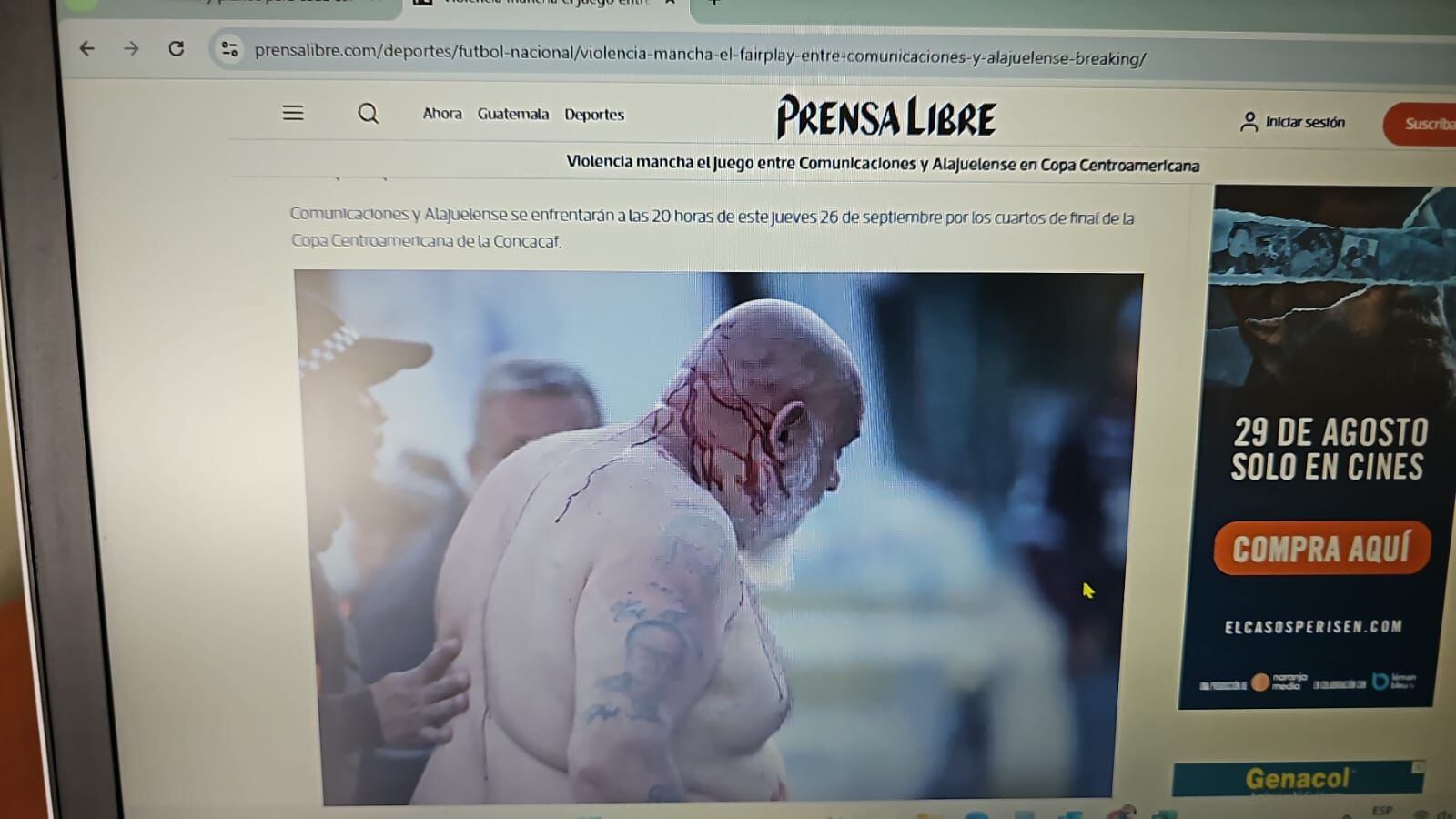 Aficionado de Alajuelense agredido en Guatemala, Christian Castro