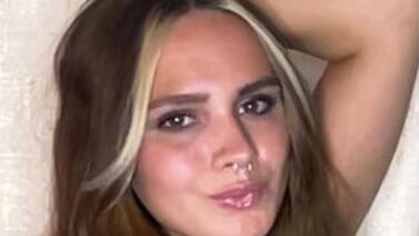 La influencer Bri Over pide ayuda en TikTok para pagar millonario tratamiento dental