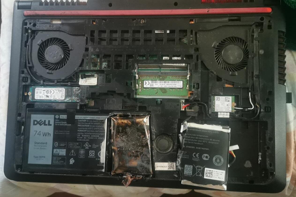 Diseñador gráfico denuncia que explosión de computadora le causó graves quemaduras. Foto cortesía. Frank Murcia.