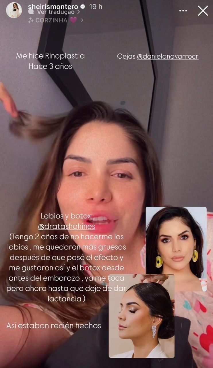 Sheiris Montero salió a aclarar qué arreglitos se ha hecho para estar tan cambiada en comparación con hace nueve años