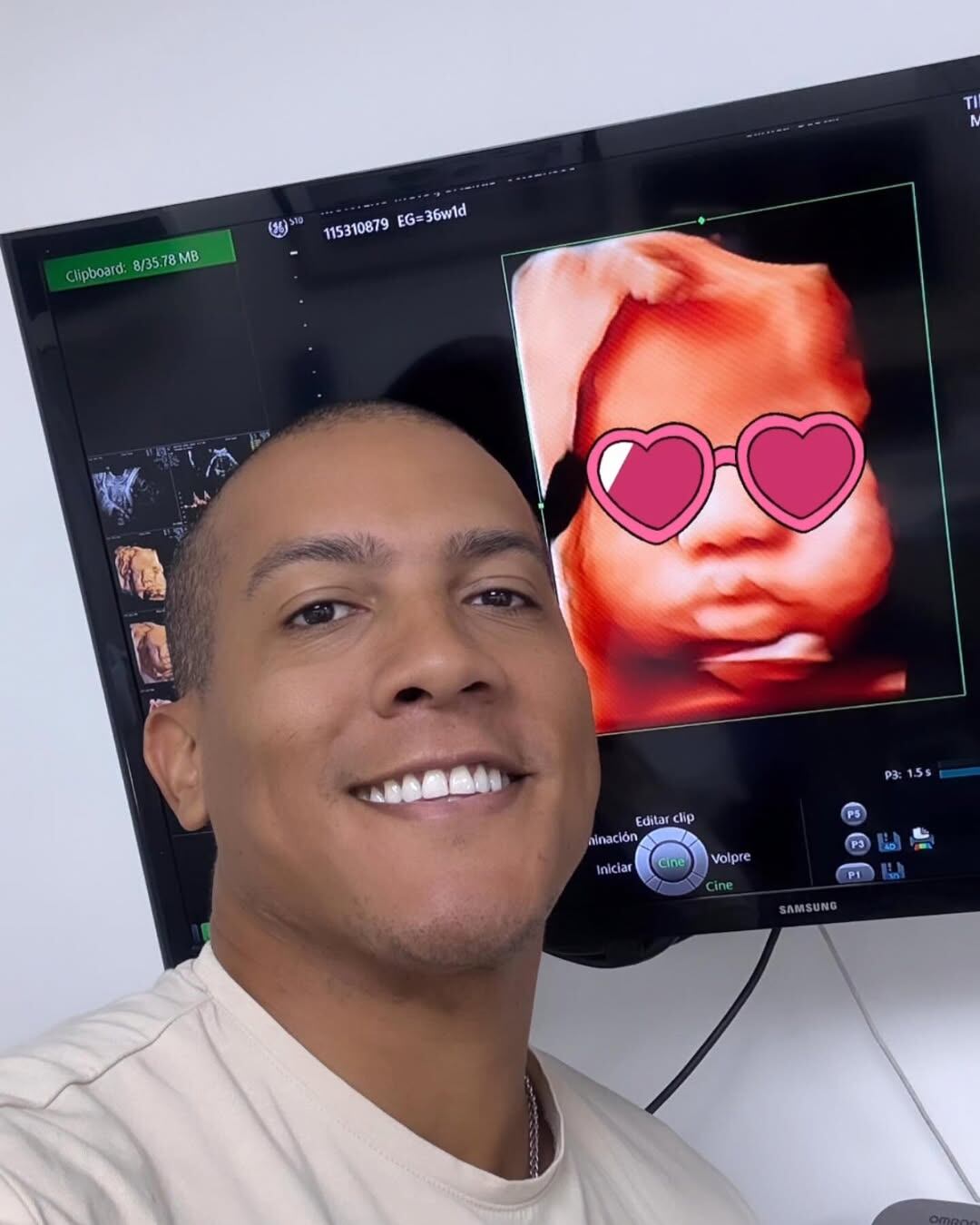 Greivin Morgan derritió los corazones de muchos de sus seguidores en redes con una foto que compartió de su hijita a pocos días de nacer.