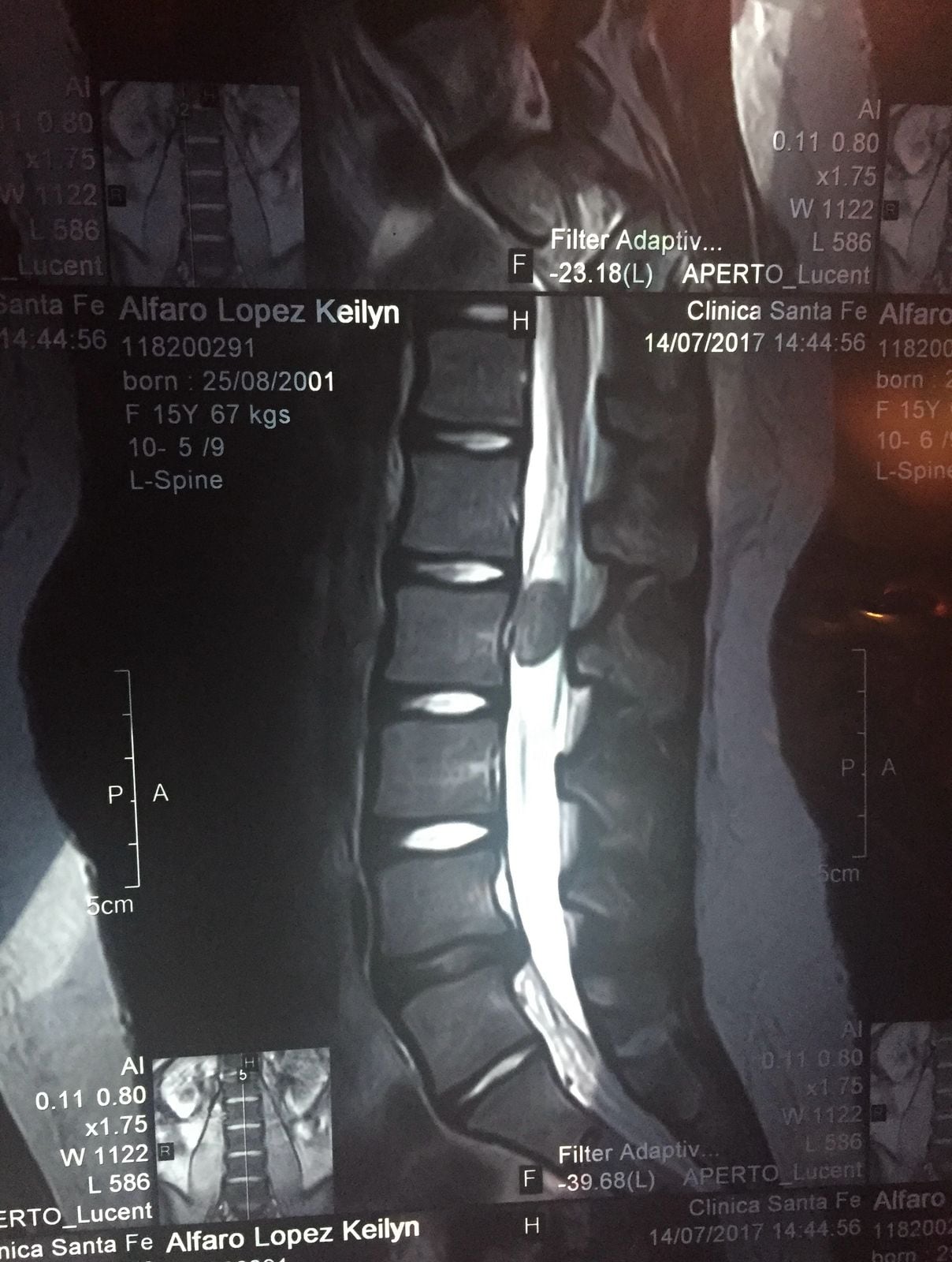 Keilyn Alfaro López es una valiente joven de 24 años que a lo largo de su vida ha enfrentado muchos problemas de salud.