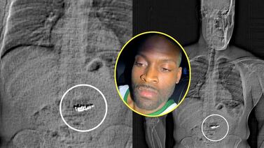 Increíble: se hizo pasar por representante de jugador de la NBA, robó joyas y se las comió