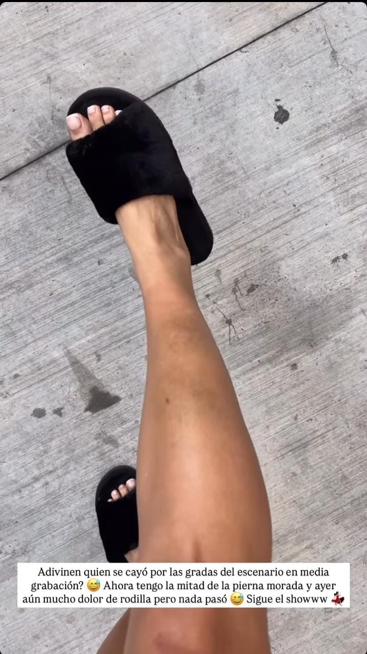 Karina Ramos se llevó tremendo golpe