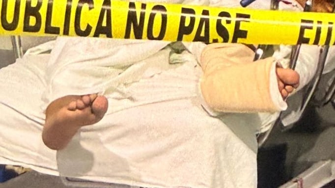 Arnold Valverde Matarrita, de 32 años, es el hombre que fue asesinado a balazos dentro del Hospital La Anexión, en Nicoya, Guanacaste, estaba internado por una lesión en una de las piernas. Foto: Cortesía