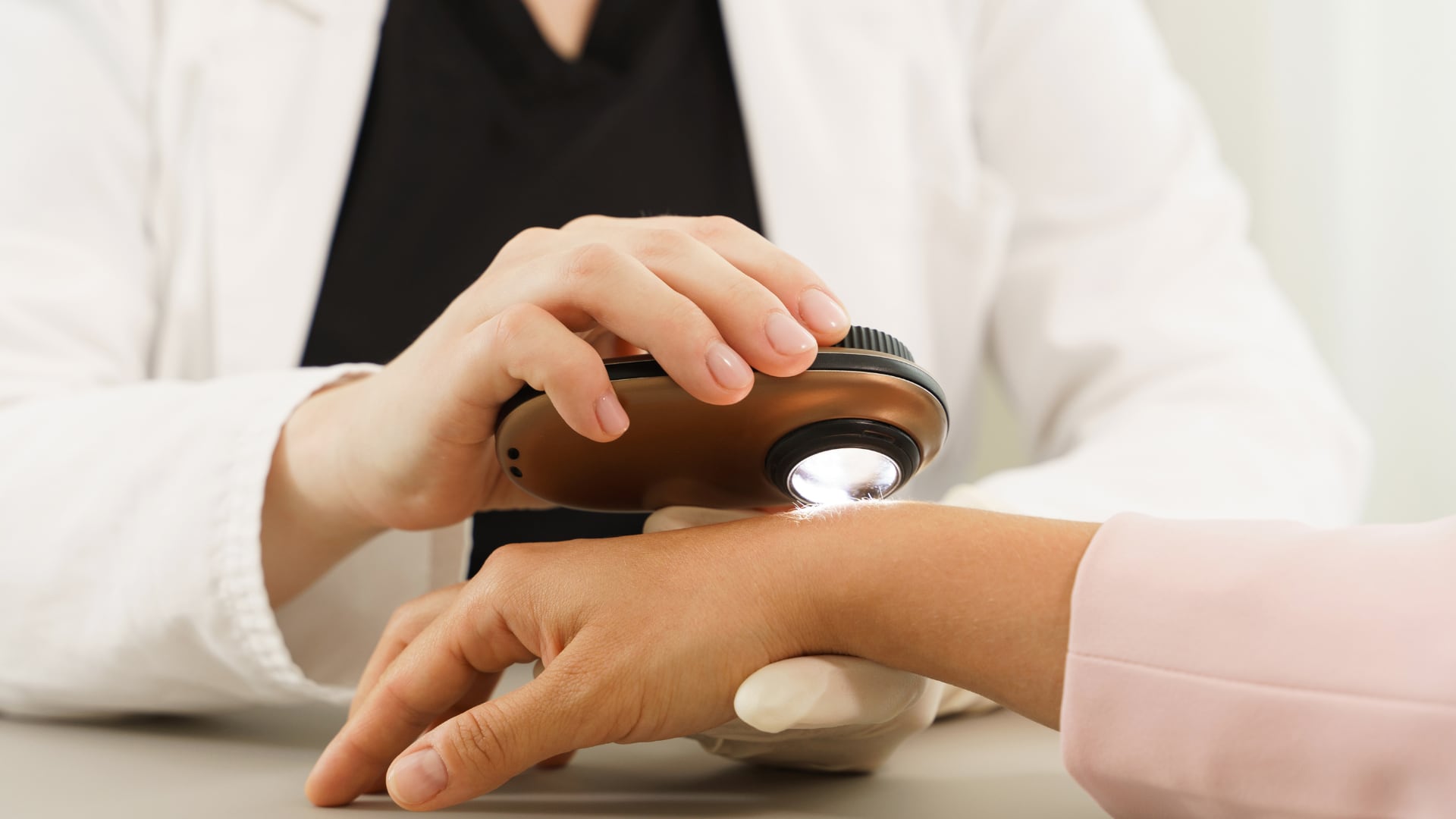 No es habitual que aparezcan lunares nuevos después de los 30 años; si ocurre, lo recomendable es acudir a una revisión dermatológica.