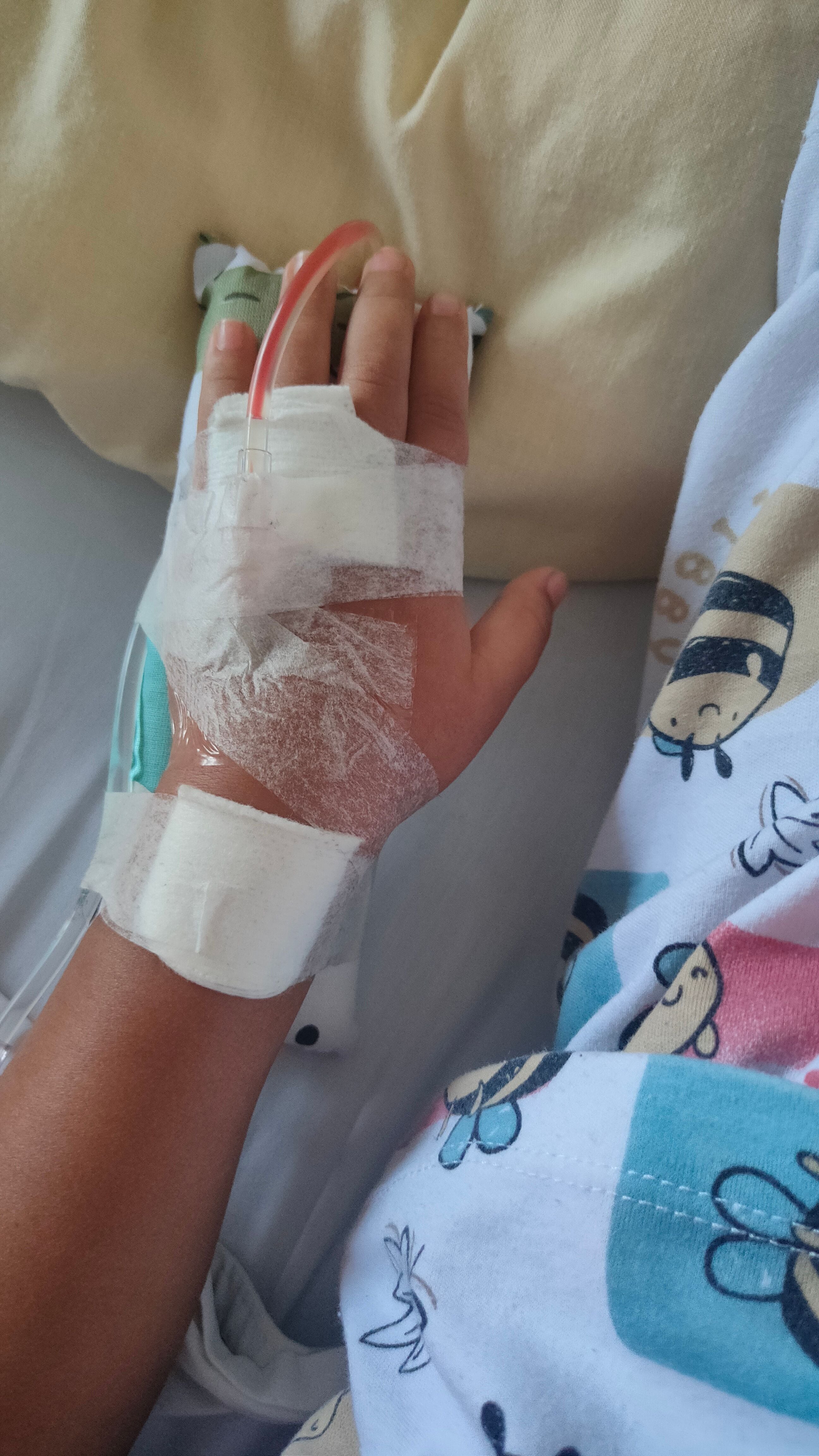 Hospital Nacional de Niños lanza alerta sobre quemaduras en niños