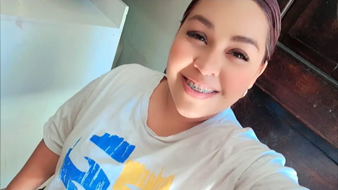 Joselyn Vallejos, de 27 años, sobrevivió a un ataque con ácido, el principal sospechoso es su expareja, papá de tres hijos. Foto: Joselyn Vallejos para La Teja