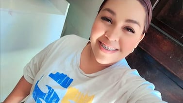 Mamá que sobrevivió a agresión con ácido lucha por su vida, pero hay algo que aún la hiere