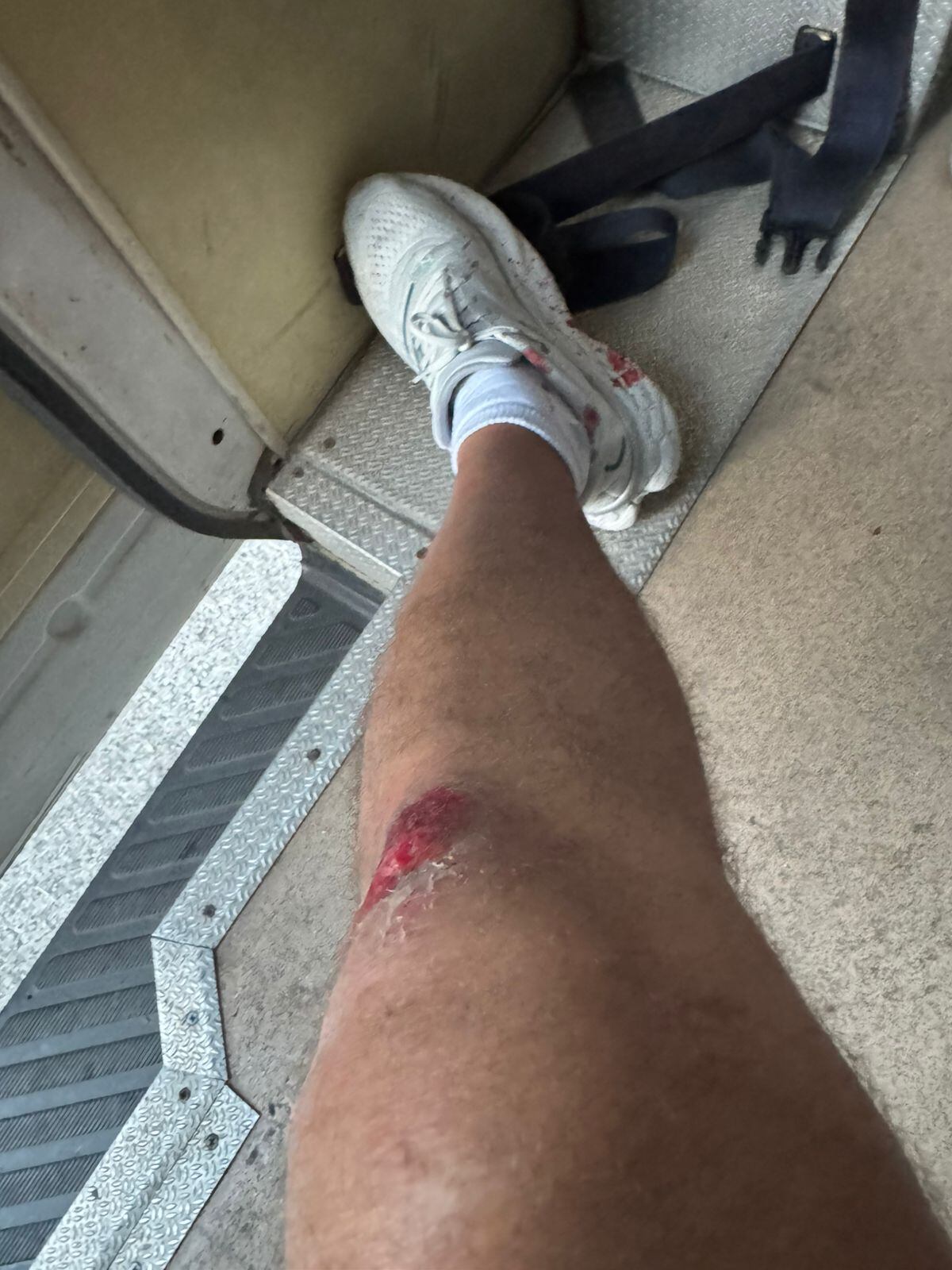 Aficionado de Alajuelense agredido en Guatemala, Christian Castro