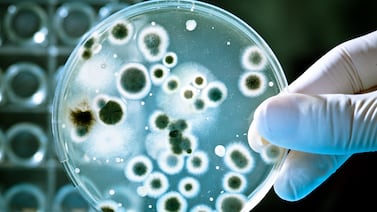 ¡Cuidado! Alertan presencia de bacteria en vegetales congelados de esta conocida marca