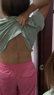 Ginnés Rodríguez y su operación en la columna.