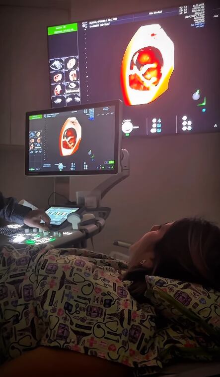 Kevin Barrantes, Gabriela Durán, embarazados